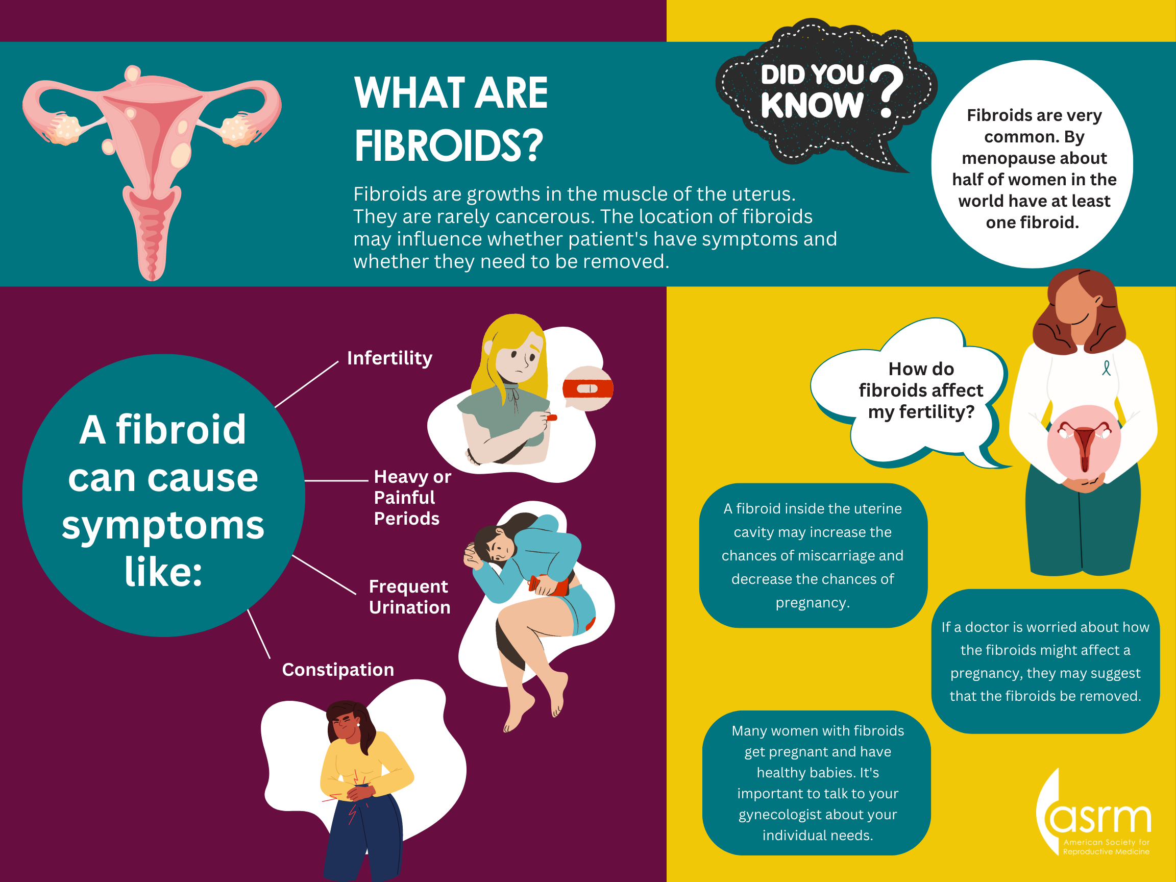 what are fibroids infographic