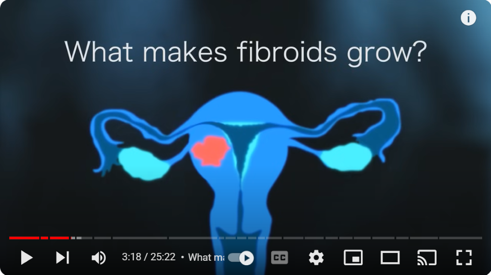 what causes fibroids to grow graphic