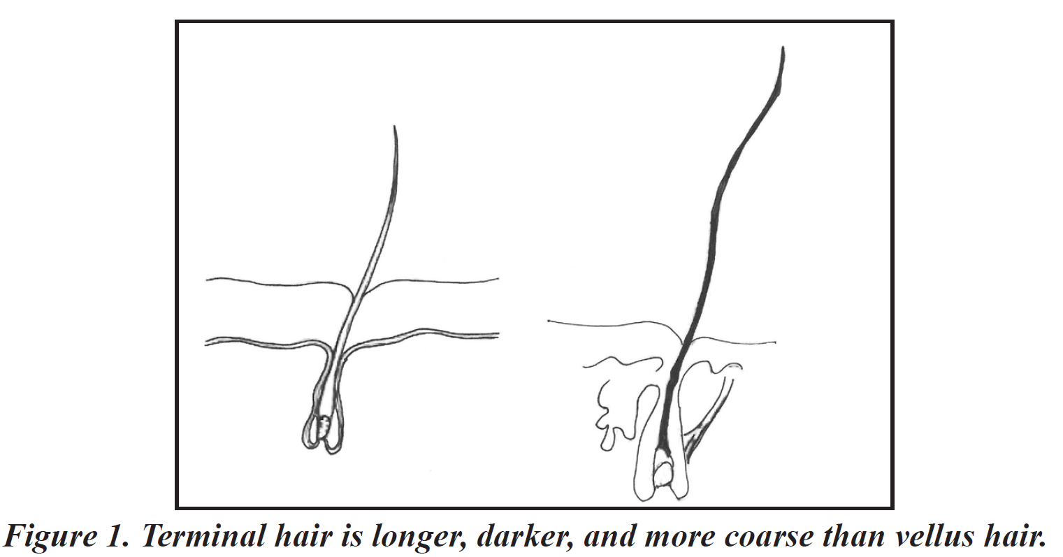 excess of hair growth - Lotus Flower PCOS