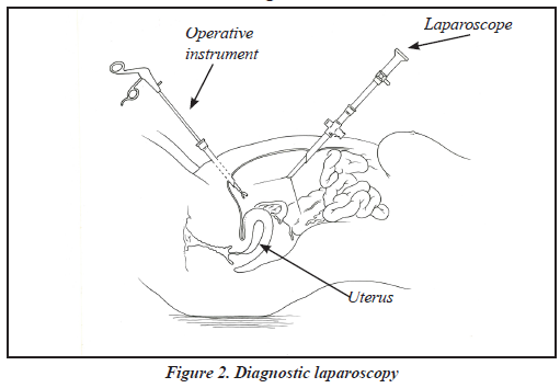 laparoscopy_Fig2.png